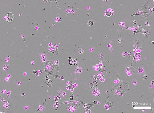 Cas12a2-induced cell death Cas12a2-induced cell death